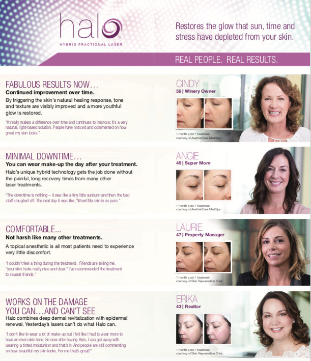 Sciton HALO Patient Education Brochures (100)